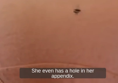 She even has a hole in her appendix