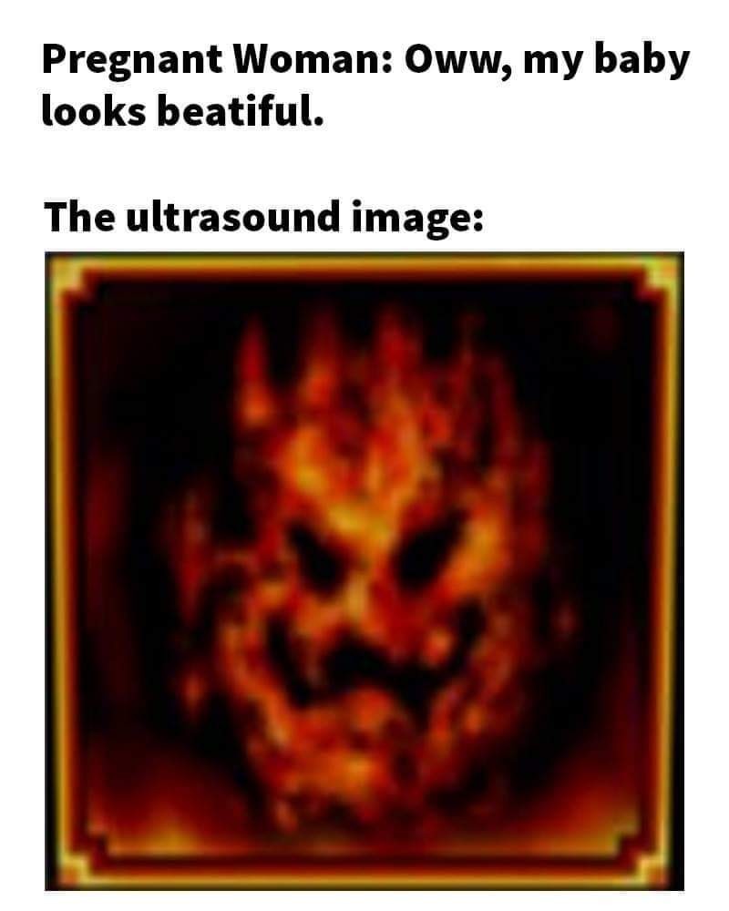 "Pregnant woman: oww [aww?] my baby looks beautiful" "the ultrasound image:" image of the Lethal Lava Land painting from Super Mario 64