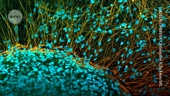 Paralysed man stands again after receiving ‘reprogrammed’ stem cells