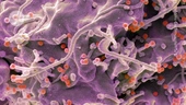 mRNA vaccines for HIV trigger strong immune response in people